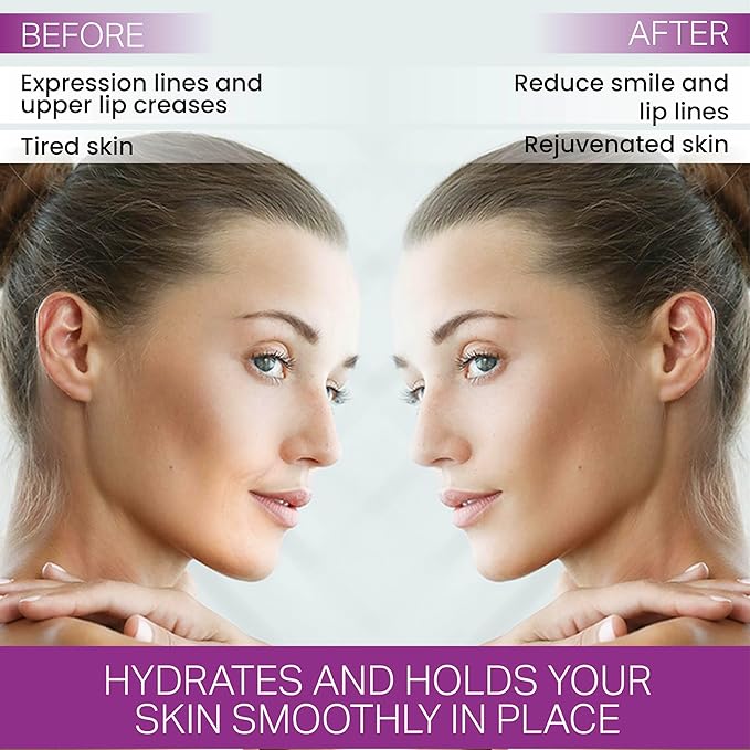 Furlesse Lip-Sticks Wrinkle Patches, Overnight Anti-Wrinkle Patches for Smile Lines, Fine Lines, and Expression Lines, Non-invasive Lip Patches, Anti-aging Skincare, 120 Patches, 30-Day Use