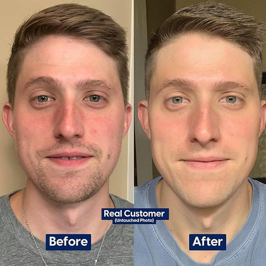 Strive - Fresh Face Jojoba Scrub - Mens Face Scrub, Fragrance Free, Smooth, Clear Skin, Refreshing with Aloe Vera, Centella Asiatica, Hyaluronic Acid & Niacinamide - For All Skin Types - 30 ML