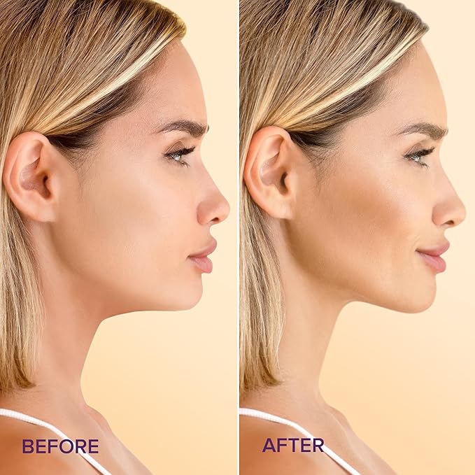 MAREE V Line Lifting Mask with 24K Gold – Deep Collagen Face Mask for Women – Jawline Shaper Mask with Retinol & Hyaluronic Acid – Neck Tightening & Firming - Double Chin Strap for Face Lift