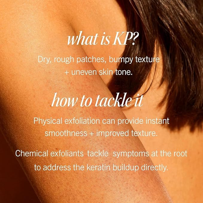 First Aid Beauty - KP Bump Eraser Body Scrub with 10% AHA, Keratosis Pilaris Skin Exfoliator with Glycolic and Lactic acids, Helps Reduce Chicken Skin Bumps, Safe for Sensitive Skin, 8 oz