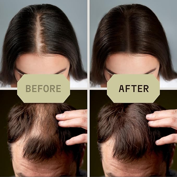 Striking Viking Hair Fibers for Thinning Hair - Building Fibers (Light Blonde) 28g - Naturally Derived Formula - Long Lasting Powder for Undetectable, Thicker Looking Results for Men & Women