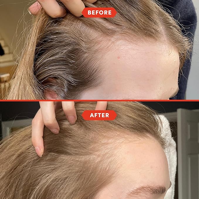 Fable and Mane Hair Oil - HoliRoots Strengthening Serum for Damaged, Frizzy Hair with Amla, Castor Oil for Hair Health - 3.4FL oz