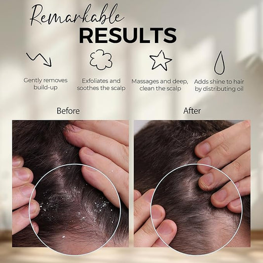 Fiora Naturals Scalp Massager Shampoo Brush - Silicon Scalp Scrubber & Exfoliator for Dandruff Removal and Hair Growth, Scalp Brush for Wet & Dry Hair, Shampoo Brush for Men, Women, Kids - BPA Free