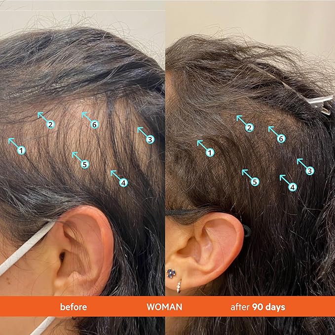 DS Labs Revita Shampoo Travel Size – High-Performance Hair Density Shampoo, Volumizing & Thickening, Fuller, Healthier-Looking Hair, Sulfate & Silicone Free, For Men & Women, 100mL